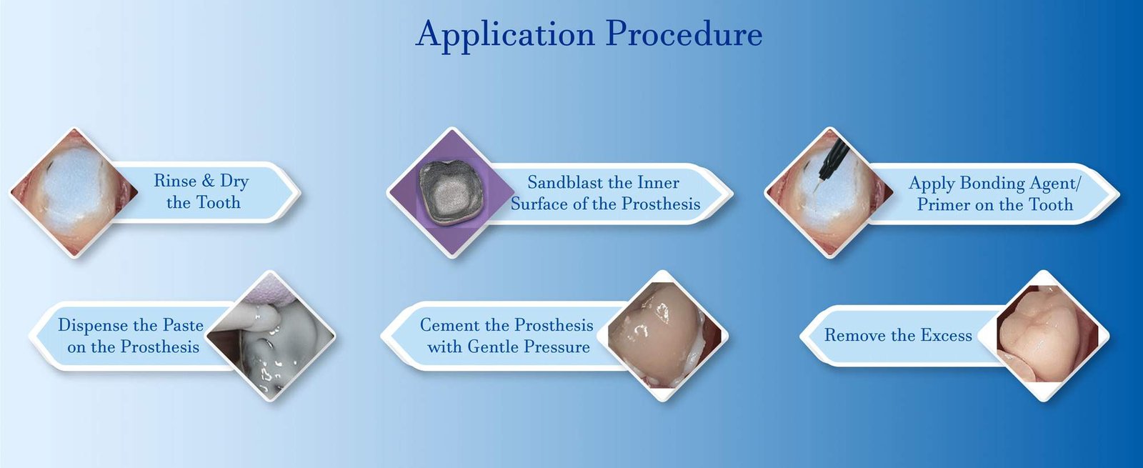 Resin based luting cement