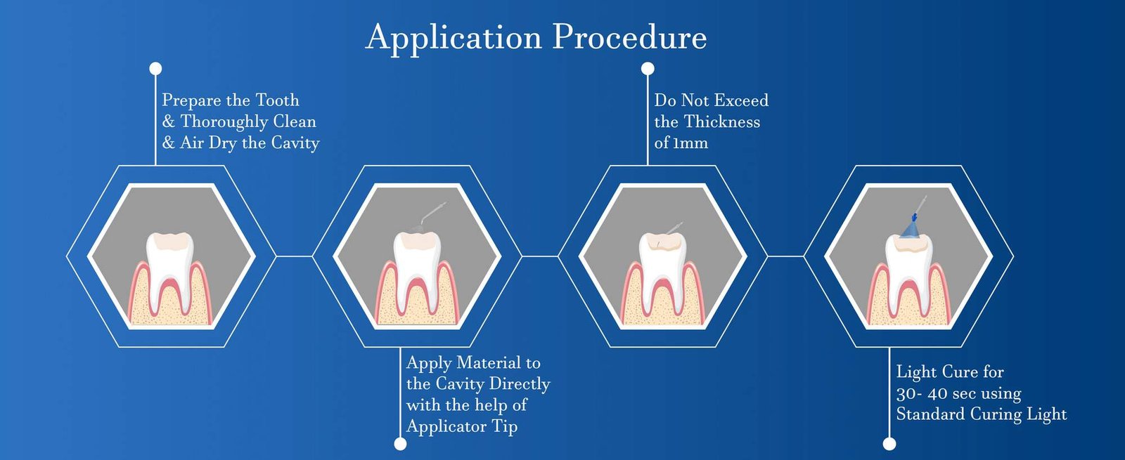 Light cure glass ionomer cement (GIC)