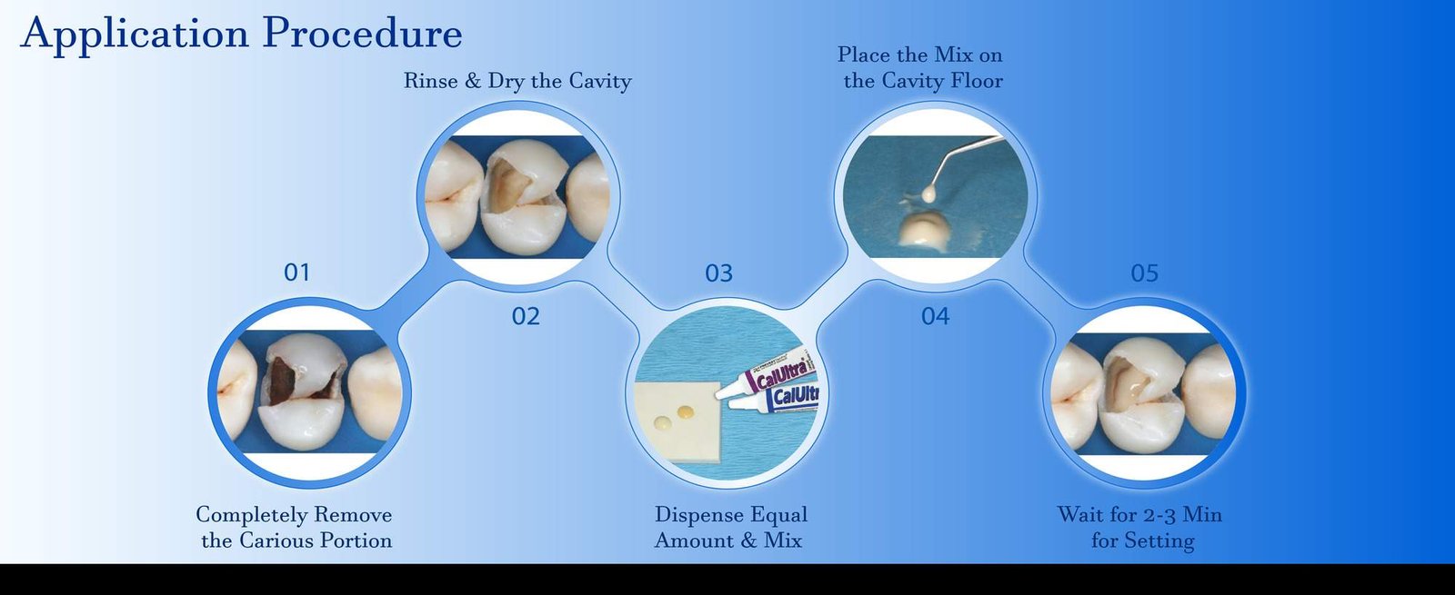 Dual component calcium hydroxide lining cement