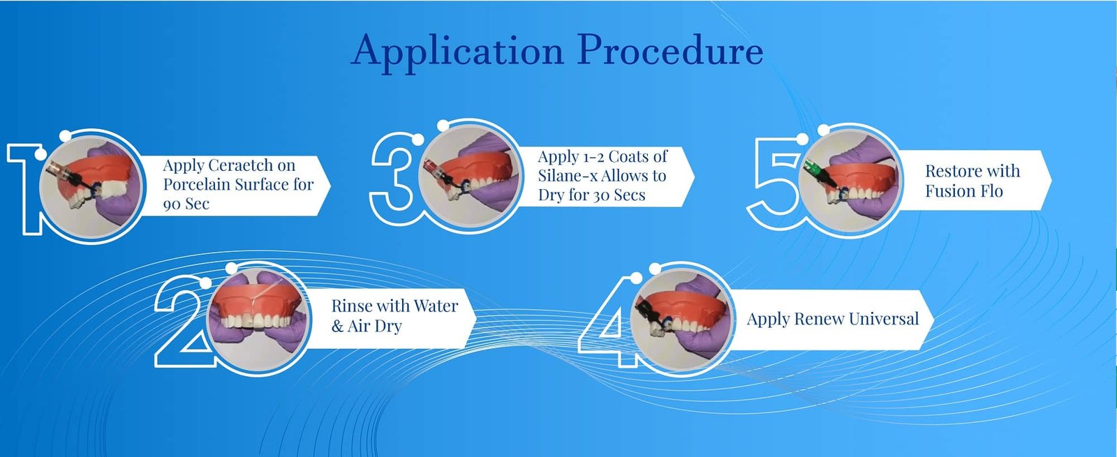 5% buffered hydrofluoric acid gel