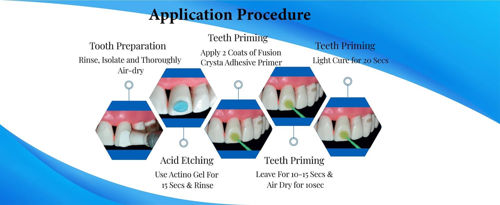 Orthodontic adhesive