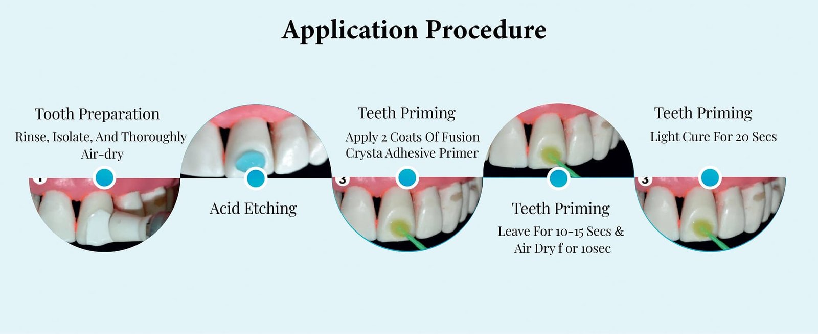 Orthodontic Adhesive primer