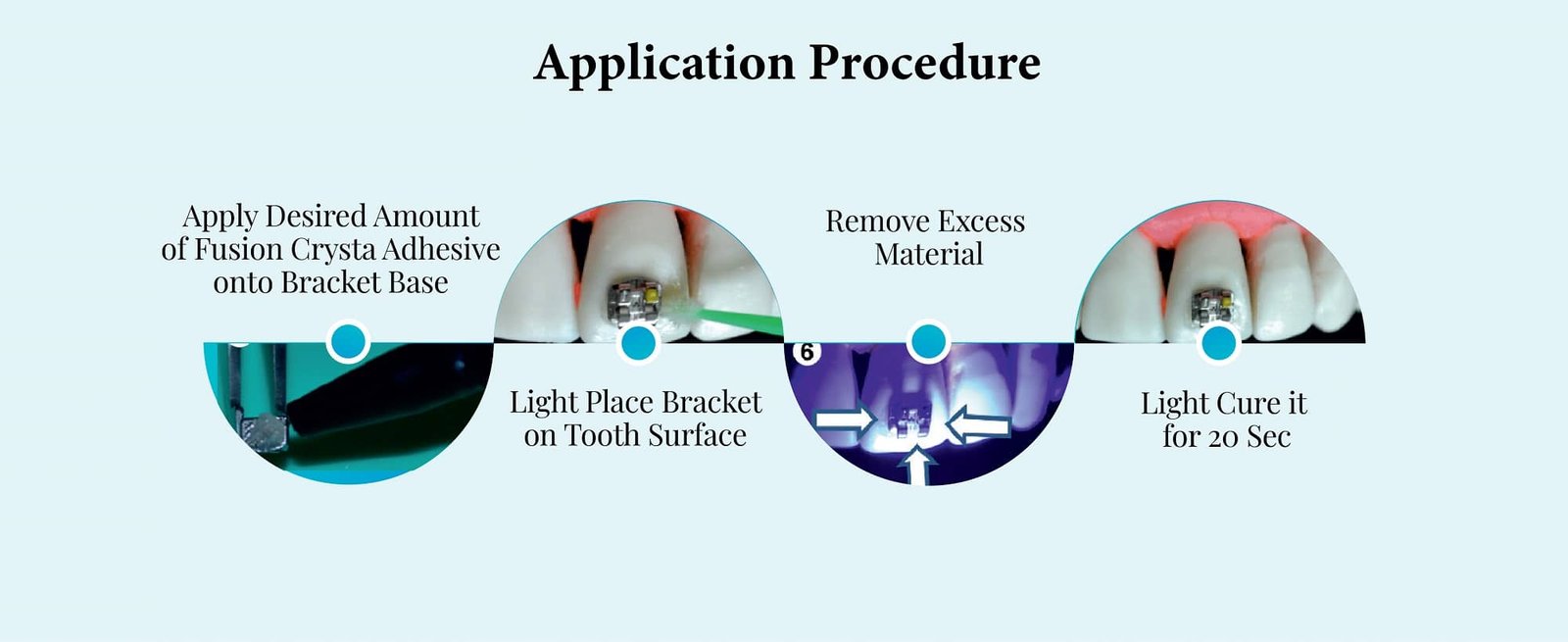 Orthodontic Adhesive primer