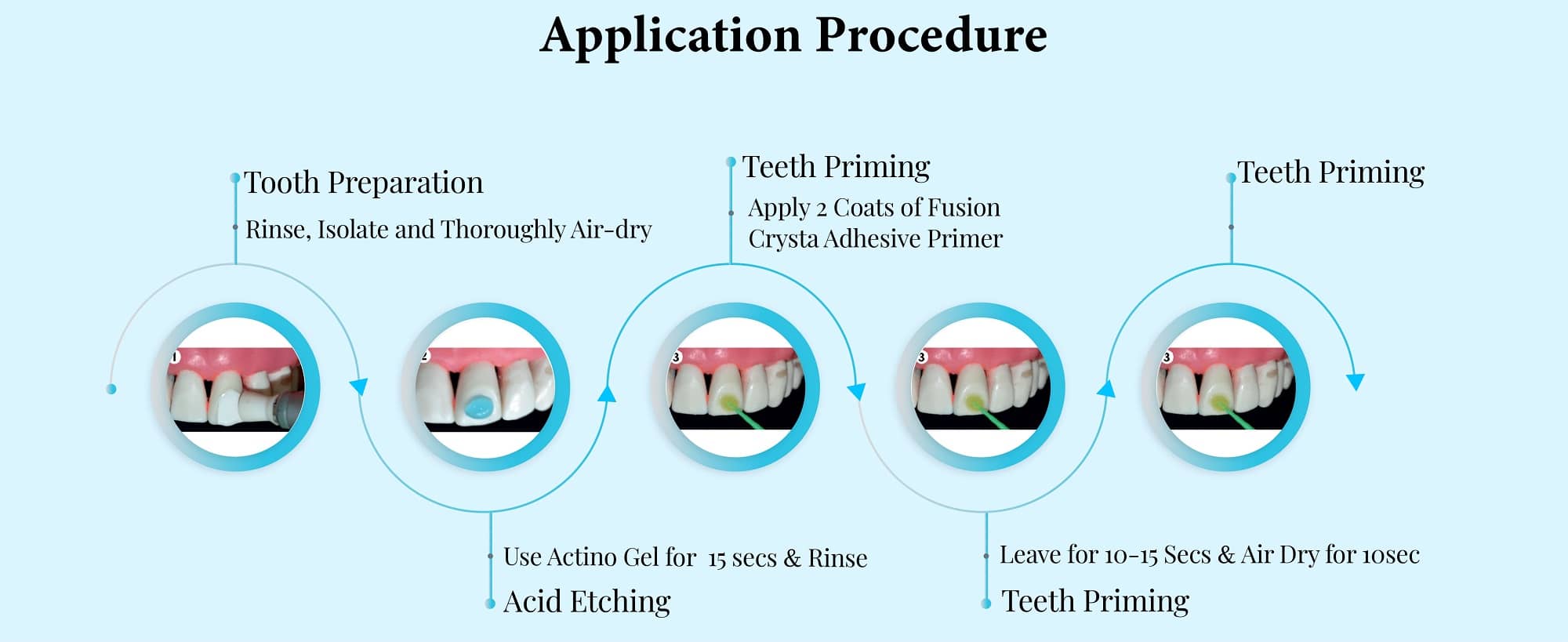 Orthodontic Adhesive Kit